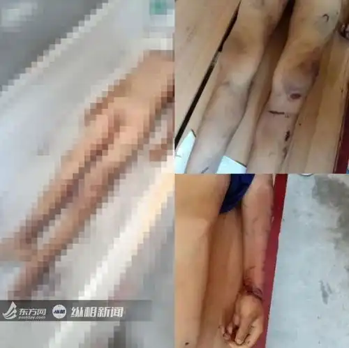 12岁男童惨死家中,弟弟8年前被卖掉,这对父母心够狠已被拘