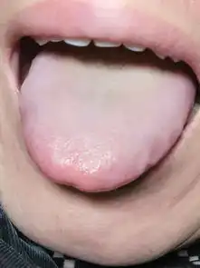 看舌头能看出来身体湿气吗