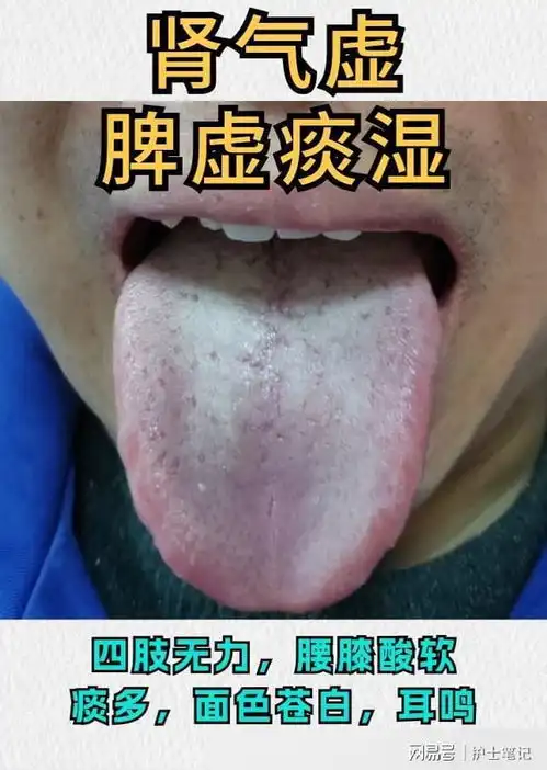 今天继续挑战全网收集舌象99个,你发我看,最快10分钟内出结果