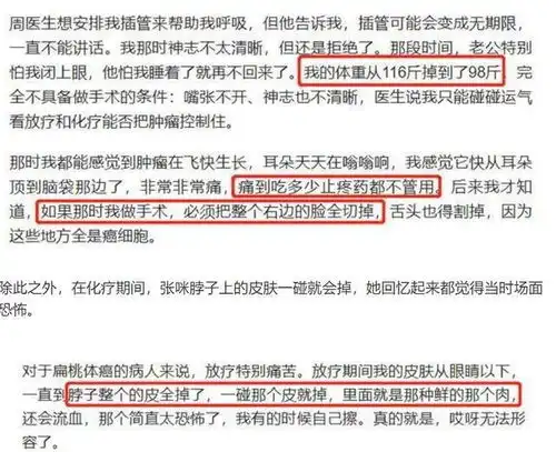 一代天后张咪自曝抗癌经历三个月不刷牙瘦20斤