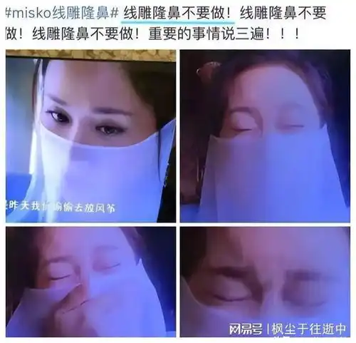 明明歪瓜裂枣,却能美若天仙,这5位女明星整得太惊艳了