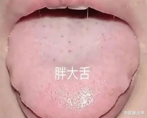 阳气越虚越睡不着,教你对症调理,把阳气补到根儿上