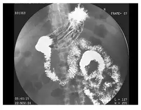放射医学医学高级x线考试试题最新版