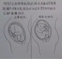 一个爸爸用漫画描绘出老婆从怀孕到生产的所有细节,瞬间泪奔
