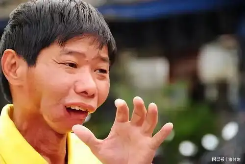 揭秘槟榔致癌之谜你知道碱的危害吗
