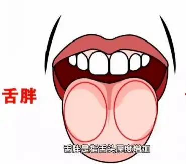 吃饭时总咬到舌头背后隐藏的问题可不小,需谨慎