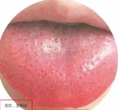 对付病毒,切莫盲目哄抢双黄连口服液专家提醒使用中药需辨证论治