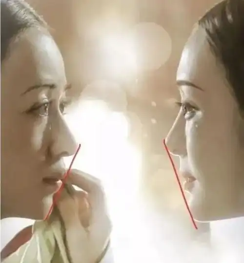 盘点让人小鹿乱撞的侧颜杀明星,嘴凸侧颜不好看做牙齿矫正能改善多少呢