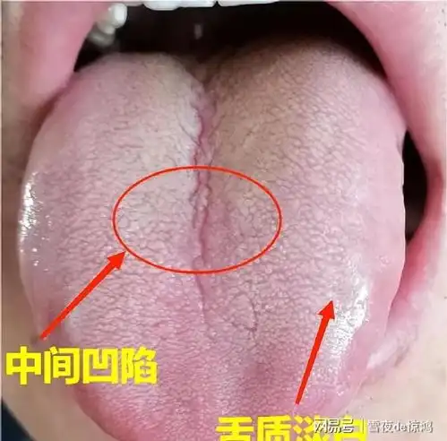 养肝就是养命这4种舌象的人,一定要会用逍遥散能摆平这几种病