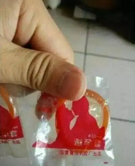 厉害40年前的避孕套竟然长这样,南宁人都看看