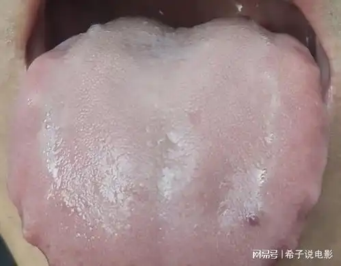 湿重大便稀热重大便粘火旺大便干你是哪种3种舌象对号入座