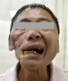 这个零食含一级致癌物,好多人还在吃
