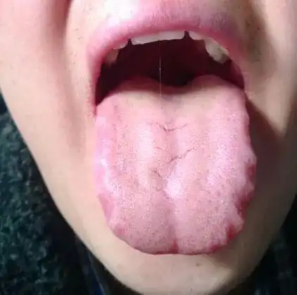 气血不足,容易疲劳的中医调理法十全大补汤