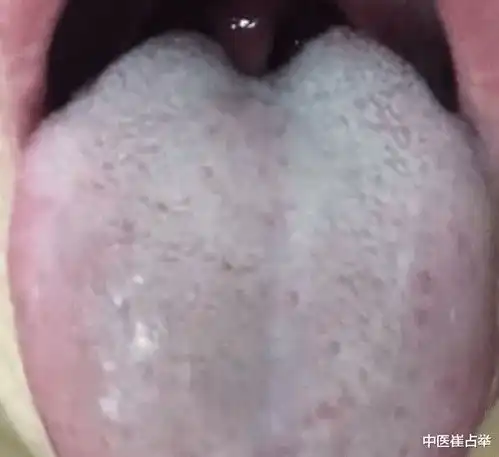 阳气越虚越睡不着,教你对症调理,把阳气补到根儿上