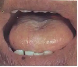 舌诊,值得珍藏