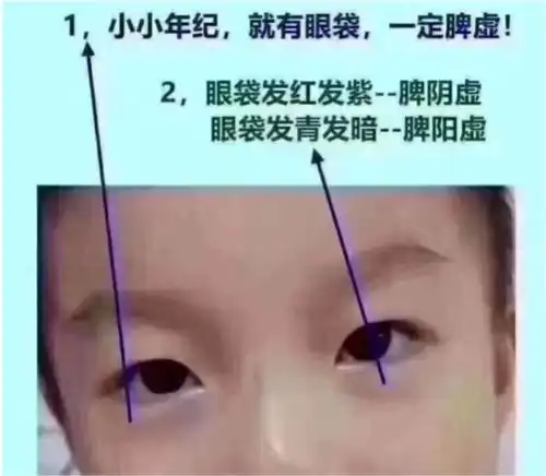 脾胃虚弱有哪些表现有哪些危害哈