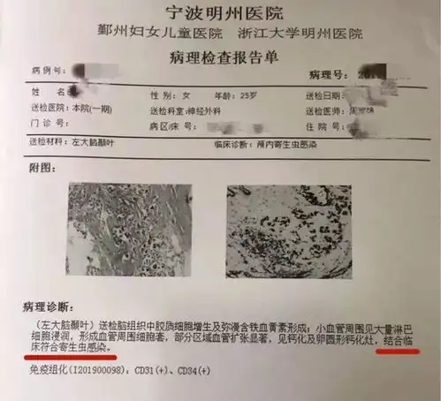 25岁女生多年头痛,竟因脑袋里有活物在挖隧道