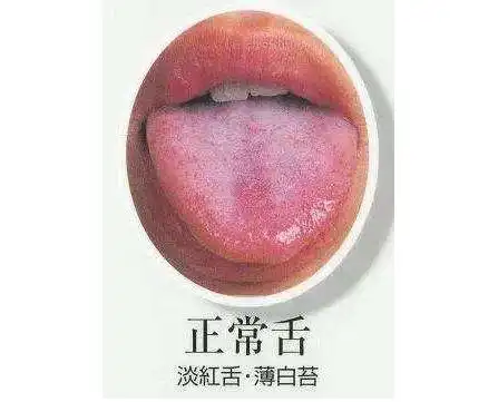 医生提醒舌头出现这些变化,得赶紧治疗