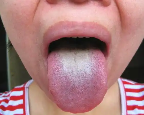 这样泡泡脚十年的湿气脚气全无