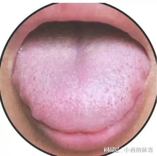 养气就是养命,教你3盒中成药,补一身气虚还不上火