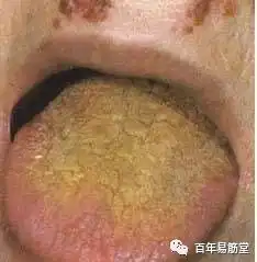 舌诊图谱,图文对照,珍藏版