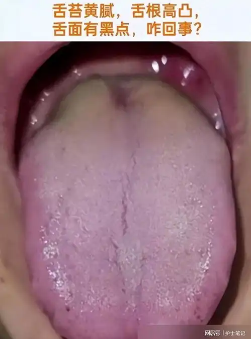 门诊舌象案例脾虚湿盛,湿热下注,阳气不足,寒湿严重