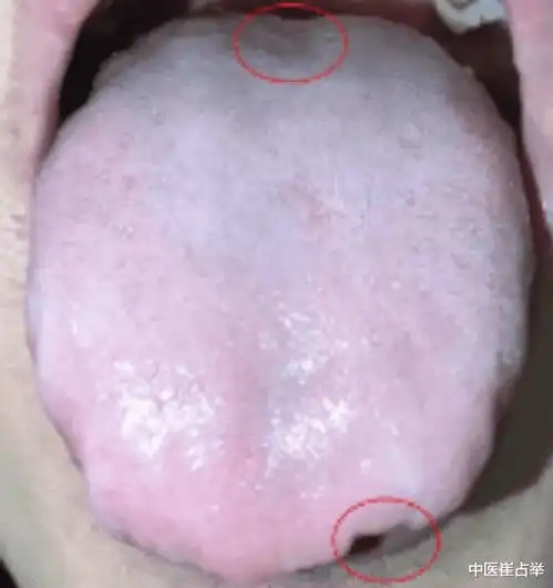 如果出现这4种异常,就说明你的肾精快用光了,千万别大意
