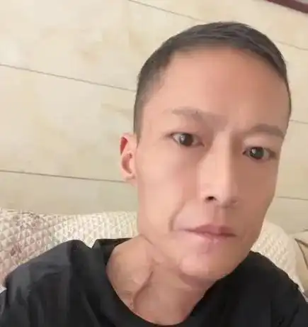 槟榔四巨头一天狂炫5包槟榔,两年死仨,剩下一个割舌保命