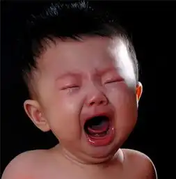 小儿三叉神经痛手术治疗