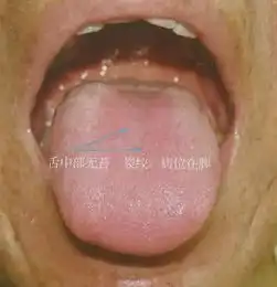 五脏证素与舌象