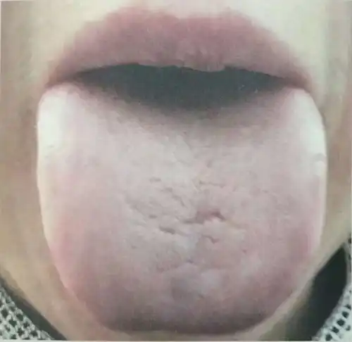 阴虚体质身体有哪些表现