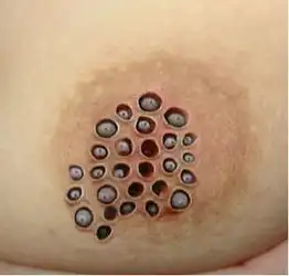十大恶心图片蓬蓬乳