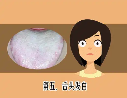 舌苔发红发黑是疾病警告医生教你如何从舌头颜色看出哪病了
