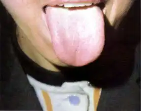 舌头像我们吐露的这些信号,在透露着什么