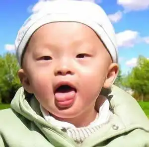 小儿推拿观舌辨病如何从舌头看宝宝是否健康宝宝易出现的5种异常舌苔及应对