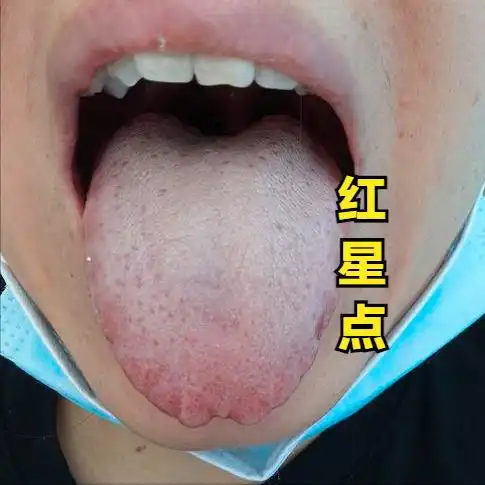 肝郁可大可小,中医教你从舌头舌象看肝郁的程度