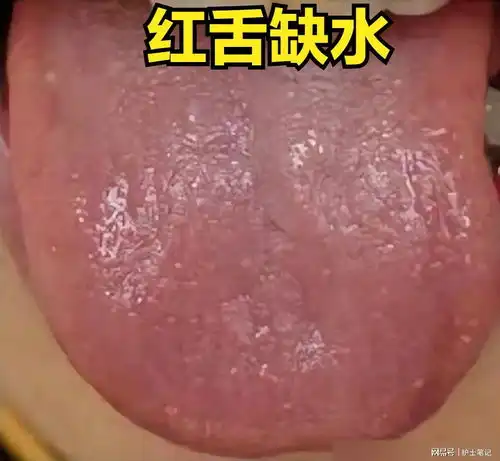 舌红缺水,舌白缺血,舌胖缺气,教你一招,一次补足气血精心火手脚冰凉舌体舌白舌红舌胖补足气血精手机网易网