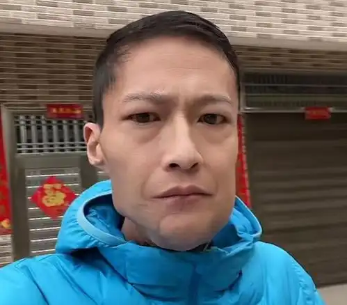 槟榔图片头像舌癌