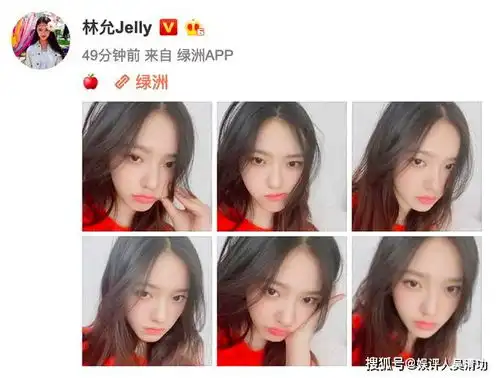 郑爽透露拍吻戏的秘密,钟楚曦受伤做针灸,吴宣仪发睡前福利自拍