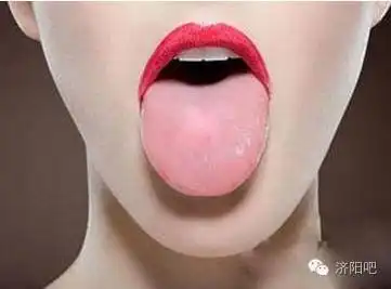 科学家标明,原来看一个人的肾好不好,看舌头就知道