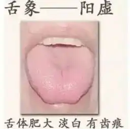 中医看舌头都在看什么
