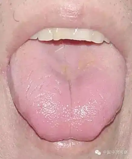 历上最全的舌诊图解收了吧