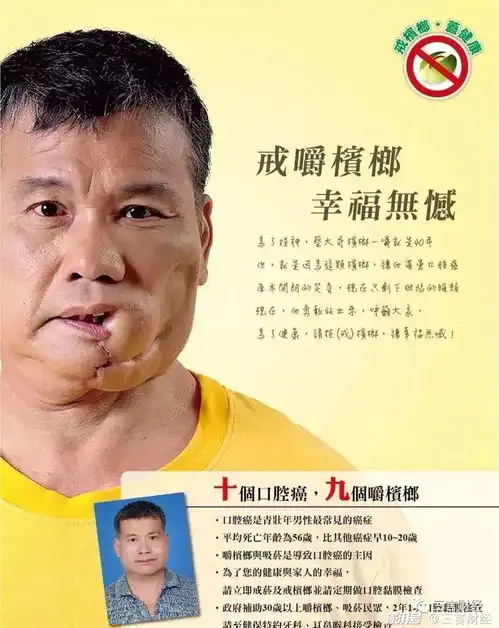 云南虫谷等现槟榔广告,此一级致癌物渗透目之所及的角落