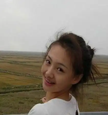 欧阳娜娜带牙套,小s带牙套,郑爽带牙套,还是她的差别最大baby