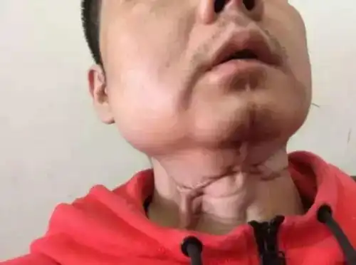 槟榔之殇成瘾只是表象,6000万人的爱好,如何成割脸切舌的诱因
