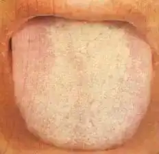 当舌头出现这个信号,你必须重视起来