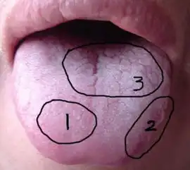 常见5种舌苔,自诊身体实虚热寒
