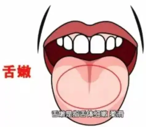 舌边齿痕舌体胖大,老国医这秘方泡水,十几年的湿气都除净