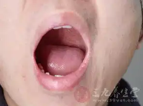 舌苔变白变厚的背后原因是什么该如何调理