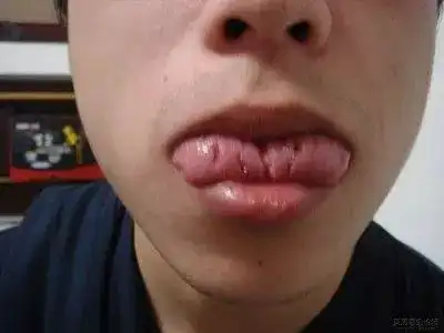 肾好不好3秒钟就能看出来,已验证男女老少通用